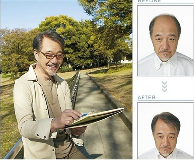 织发补发能用多久