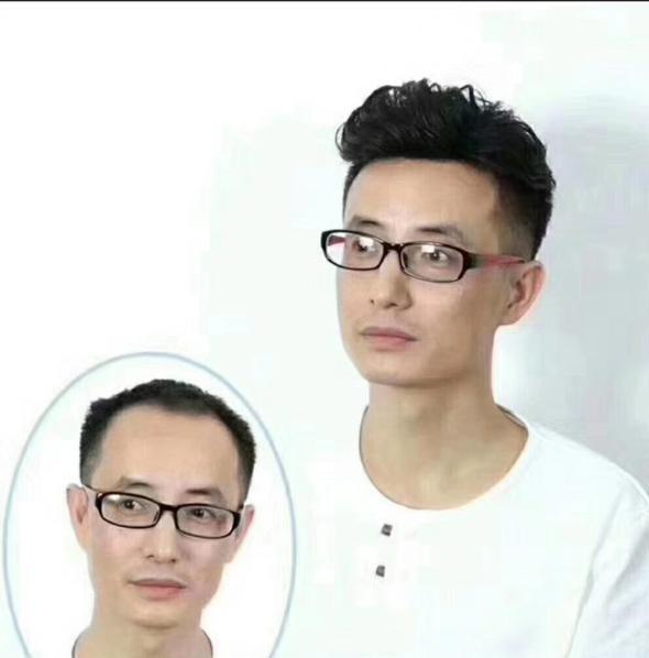 织发补发需要多少钱价格是多少?哪些人适合织发补发