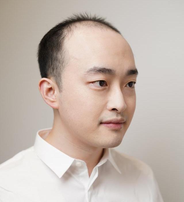 植发一次维持多久