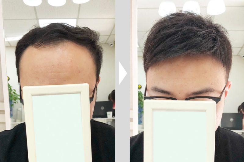 增发补发价格一般多少呢?增发补发有什么优势?