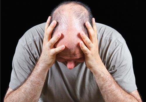 男性脱发怎么缓解？男性脱发是什么原因造成的？
