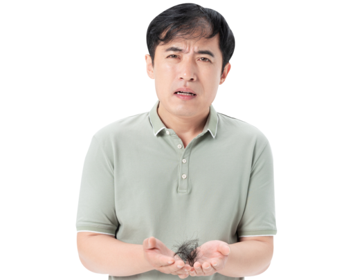 男性脱发怎么缓解?男性脱发是什么原因造成的?