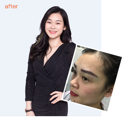 怎样治脱发和生发偏方？防脱生发要补充哪些营养素？