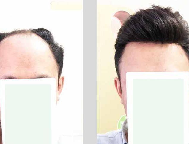 极客补发后期需不需要费用？极客补发后期费用是多少？