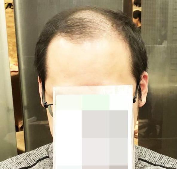 泉州唐风采补发怎么样 补发的特点