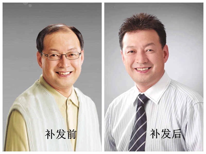 一个织发补发大概能用多久
