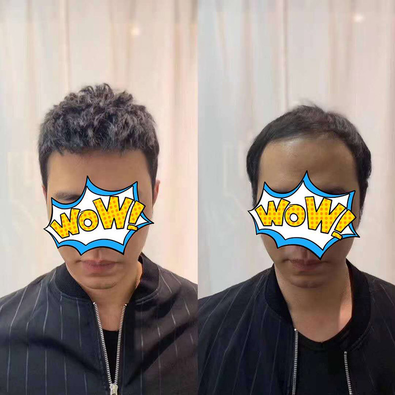 补发价格表