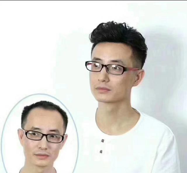 唐风采织发价格一万多吗？织发补发如何打造时尚发型？