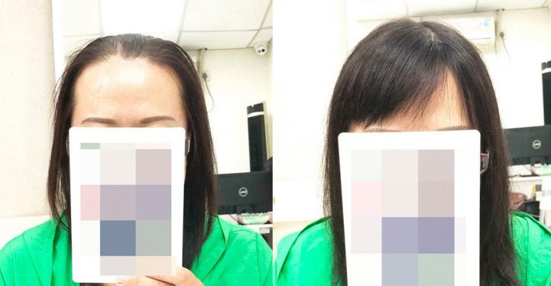 国内哪个公司的补发织发效果好呢？补发织发的优势