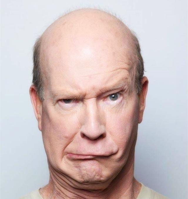 脱发是什么原因引起的男性必看，脱发最好不要吃这些食物