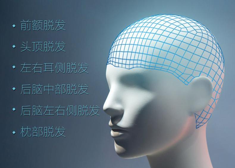 唐风采增发价格怎么样?植发有哪些危害?