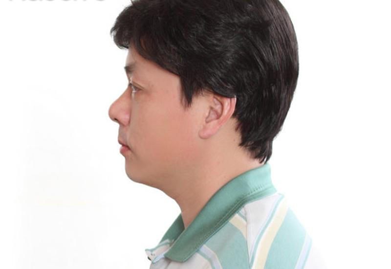 男士假发定制一般多少钱?男士定制假发怎么打理?