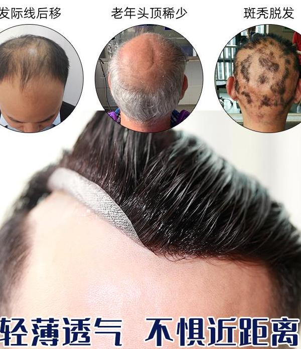 唐风采补发大约多少钱 补发怎么补