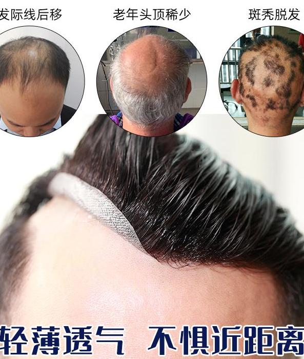 唐风采补发要多少钱 补发是怎么回事