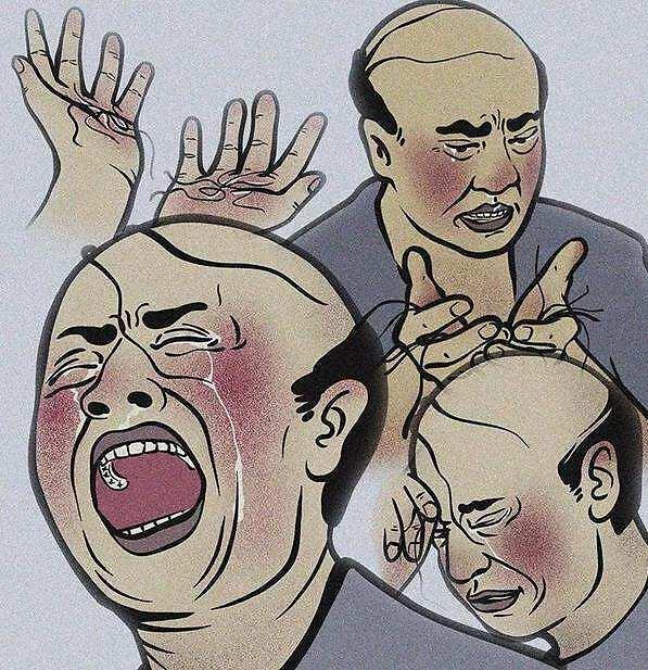 脱发严重怎么办男性   男性脱发的原因