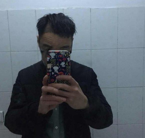 织发和植发的区别大概有哪些呀？