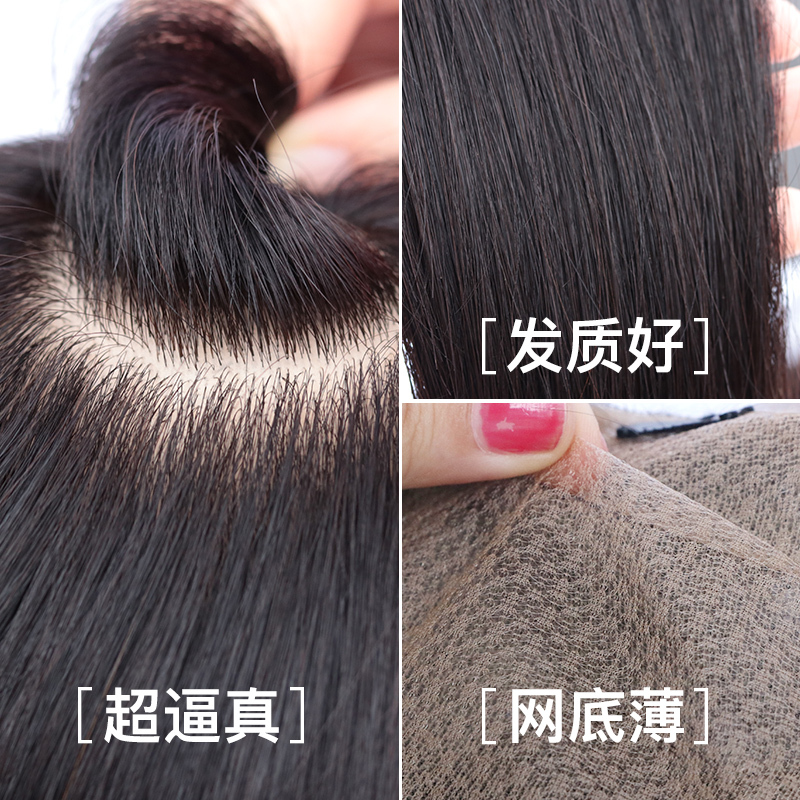 男士头顶补发片多少钱，补发的特点是什么