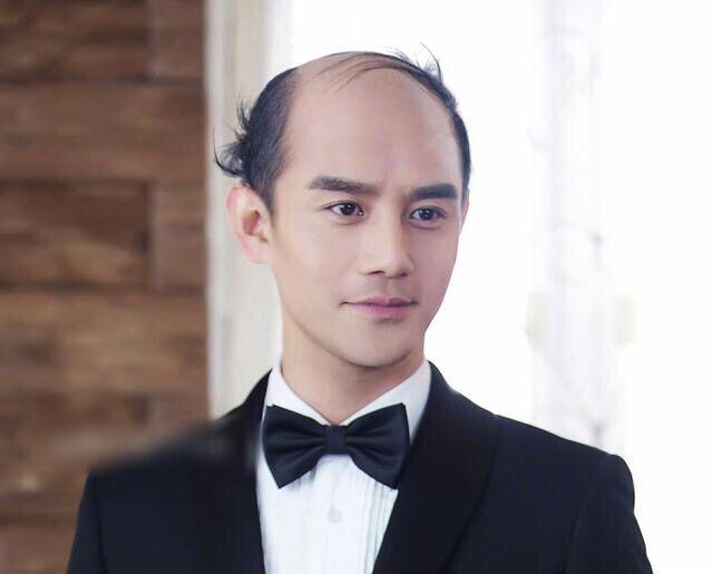 植发一个毛囊多少钱，会不会很贵呢？