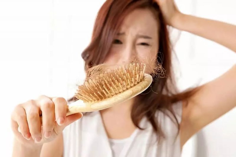 脱发严重怎么导致的
