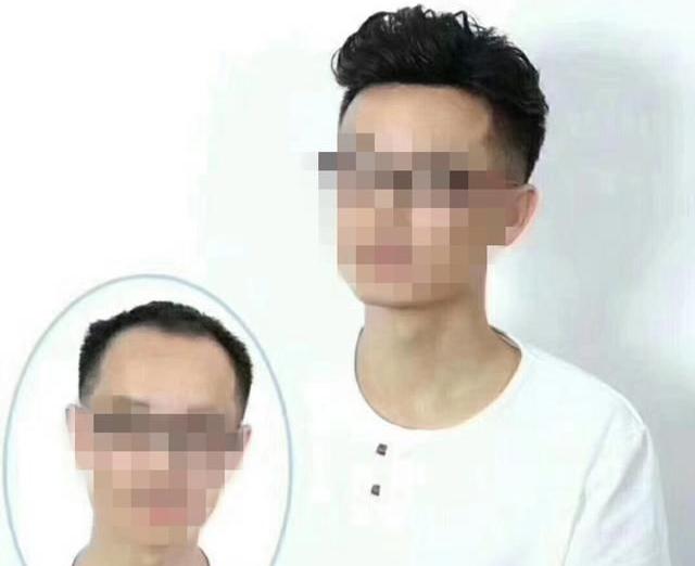 织发补发的过程是什么?怎么进行织发补发?