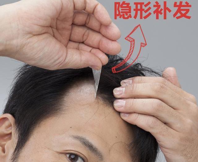 哪座城市有极客补发实体店？补发的优势