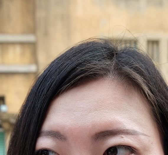 脱发还能再长出来吗