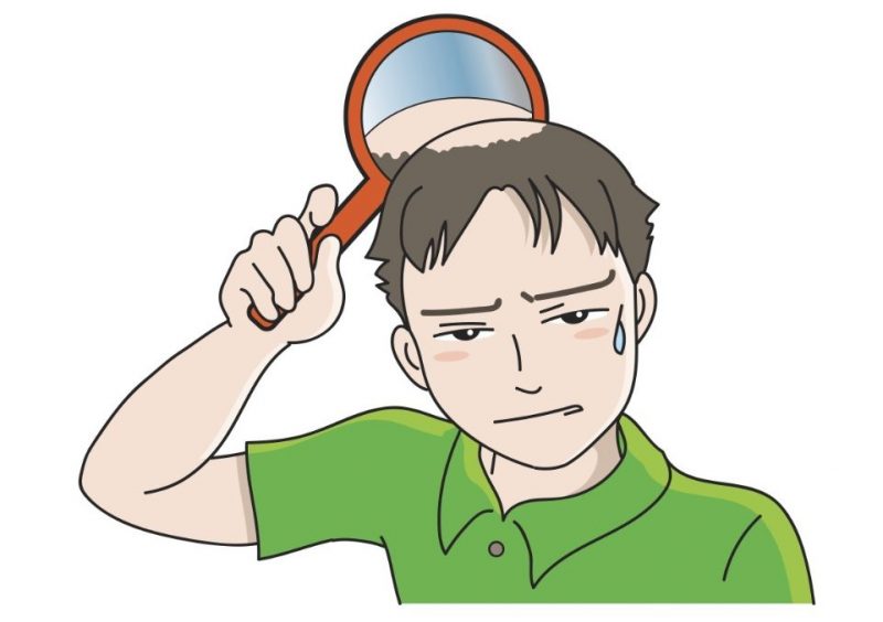 织发多少钱？织发有哪些优势