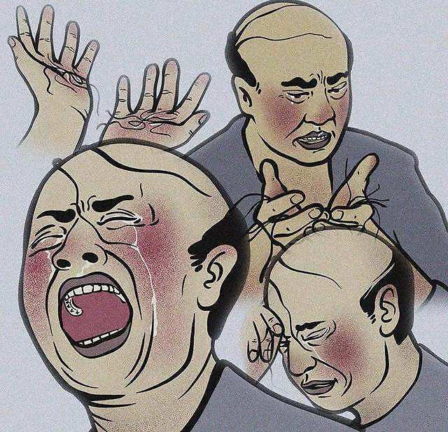 男性型脱发的原因是什么？如何治疗男性型脱发？