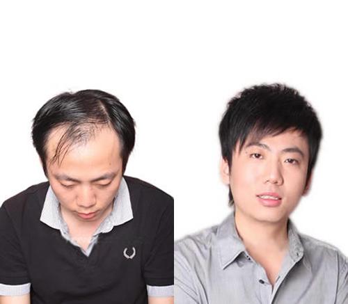 唐风采是怎么样收费的？补发的效果