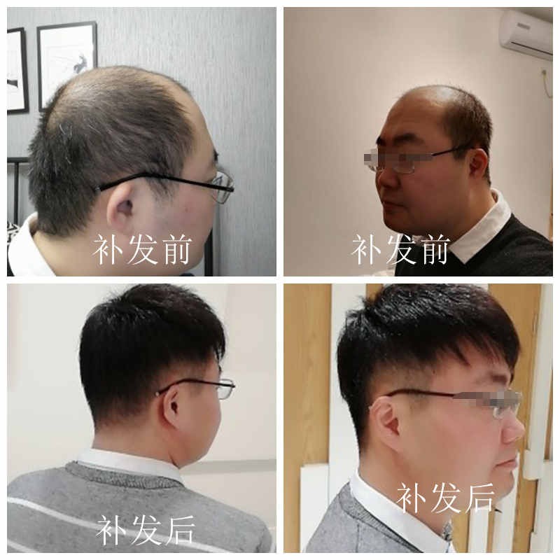 唐风采增发加盟多少钱
