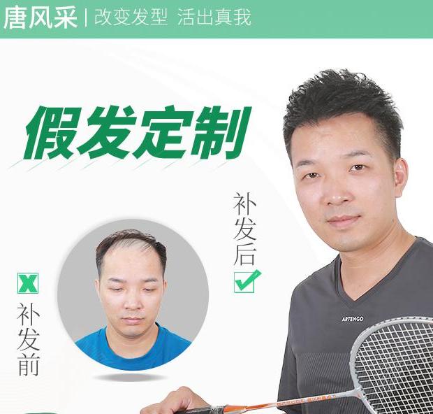 什么是无痕增发？比较火的唐风采隐形无痕增发怎么样？