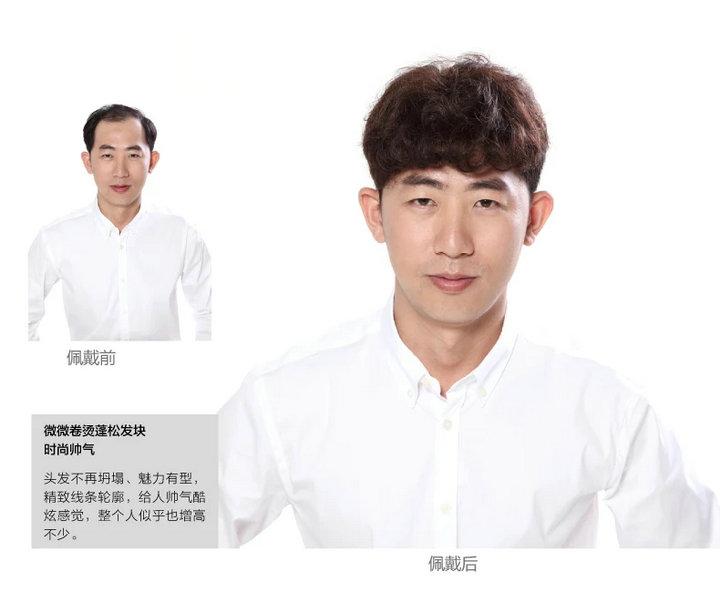 沈阳织发补发段姐地址在哪里？做织发需要多少钱？