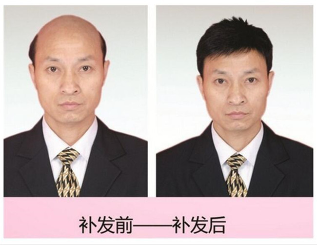 沈阳织发补发段姐地址
