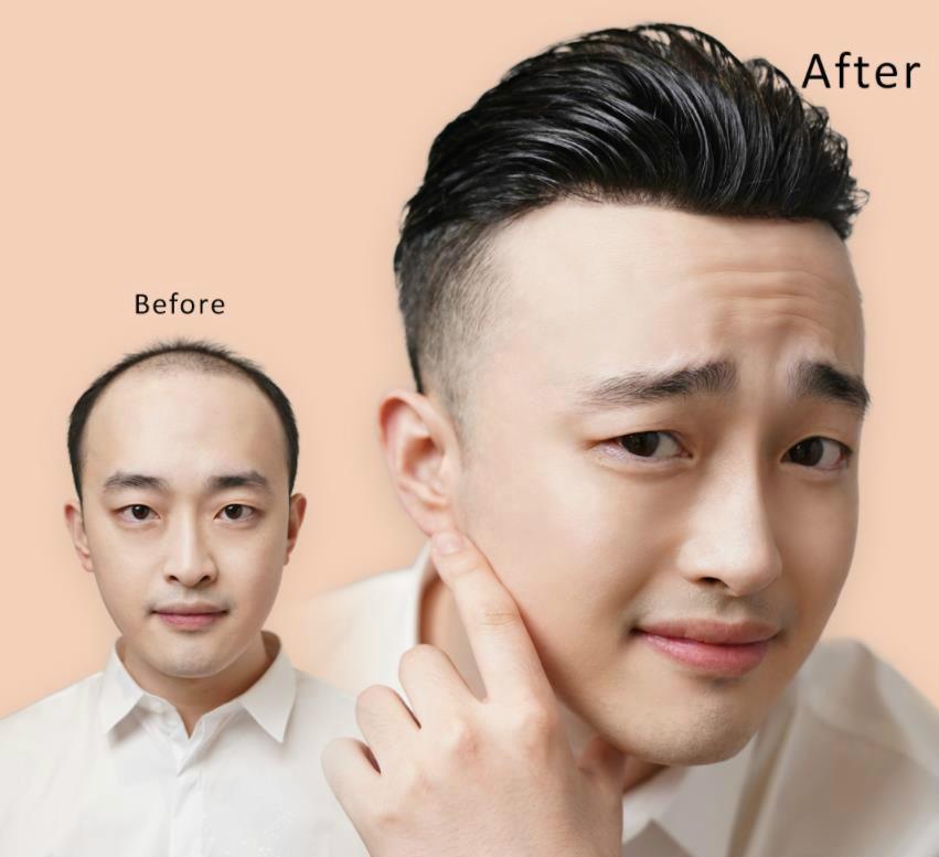 补发织发视频效果是真实的吗？织发有哪些优势