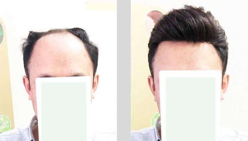 假发价格一般多少贵吗?假发什么材质比较好?