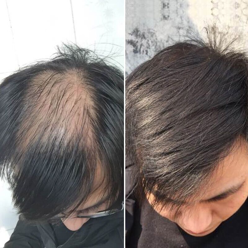 生发产品排行榜10强有什么品牌？