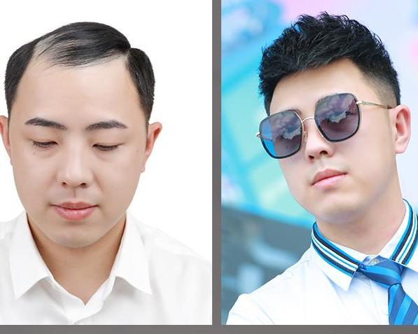 唐风采的假发好多少钱一个