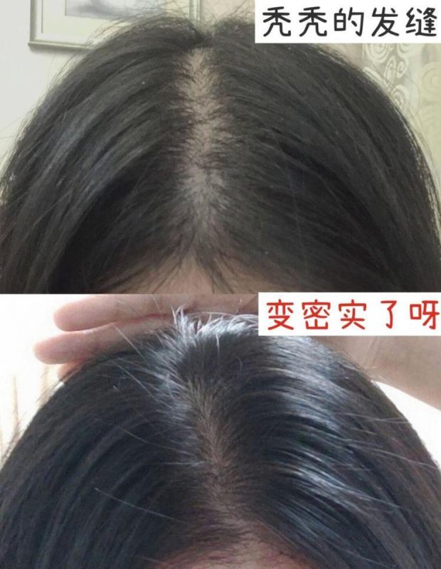 防脱发生发的特效偏方