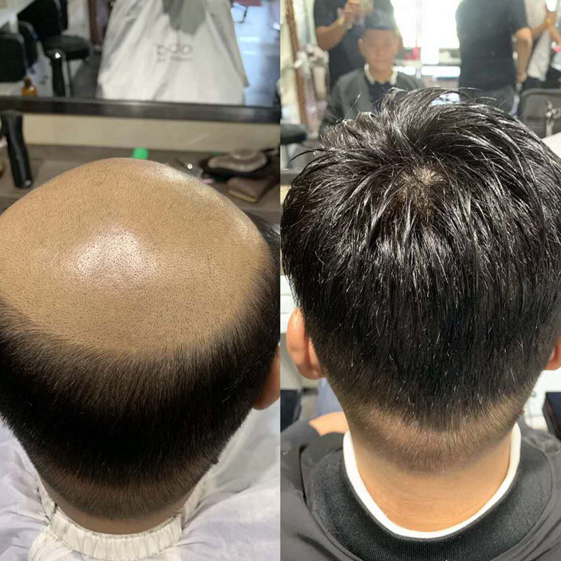 了解男士假发价格及图片，作出您的选择