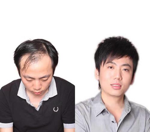 美国黑黛怎么样
