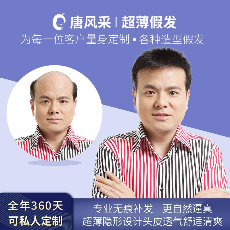 唐风采营养膏多少钱一瓶？脱发该怎么处理