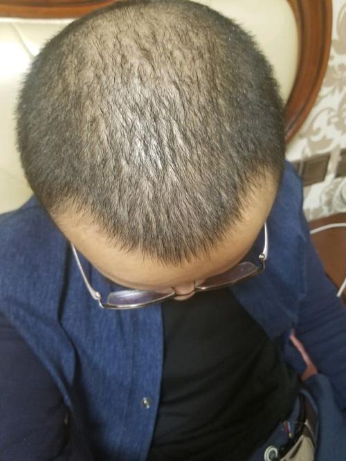 中国十大植发医院排名情况