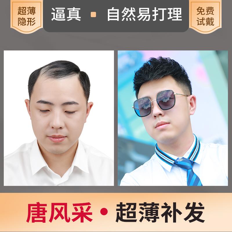 唐风采植发多少钱？织发补发的优势都表现在哪些方面？