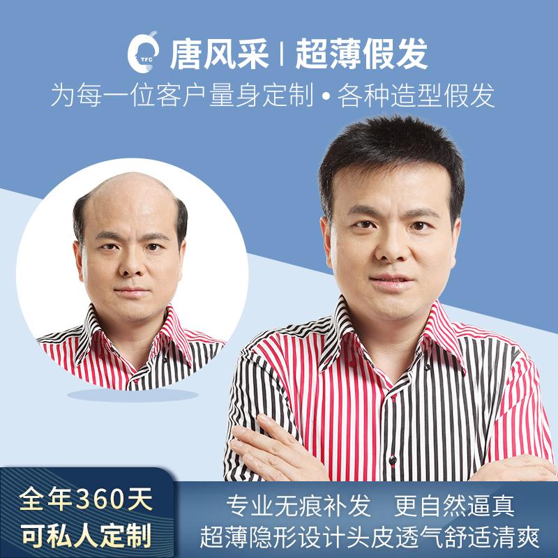 唐风采生物头皮多少钱,价格是怎么计算的