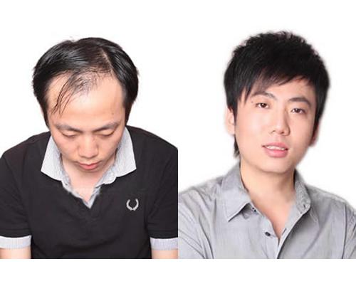 黑黛增发补发怎么样