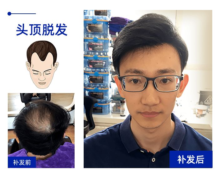 极客补发在哪有店