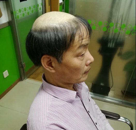 天津黑黛增发补发织发中心怎么样