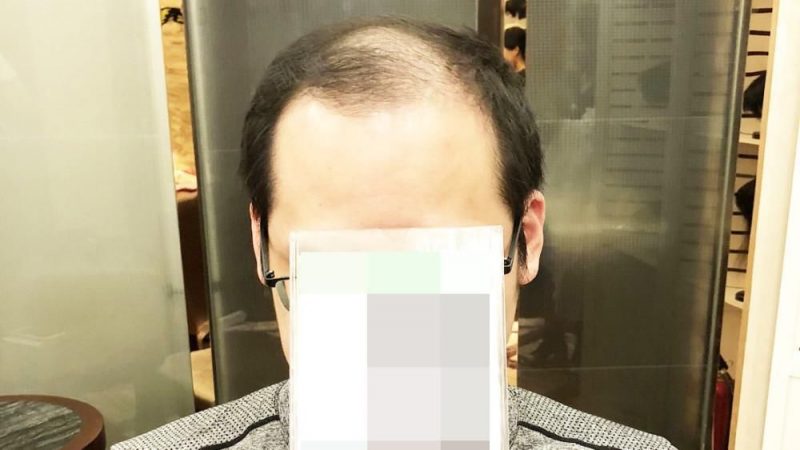黑黛补发到底怎么样