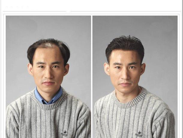 谁知道黑黛生发怎么样