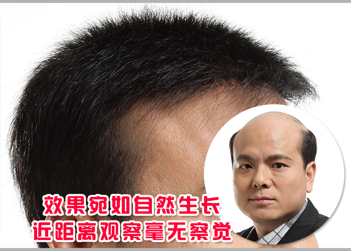 西安织发哪里有?做增发一般需要多少钱?